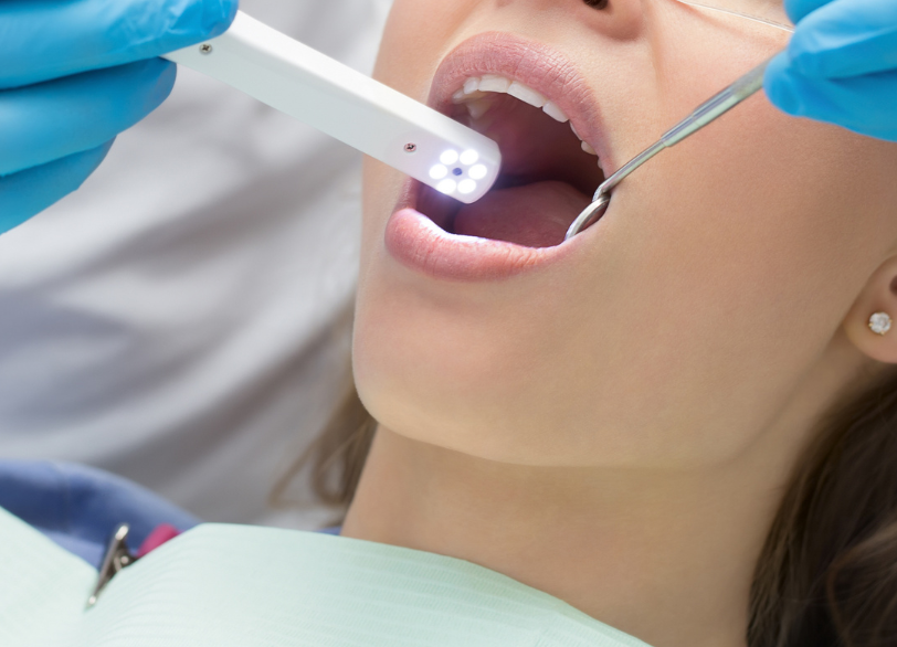 お口の中を「見える化」｜宮本医院の歯科