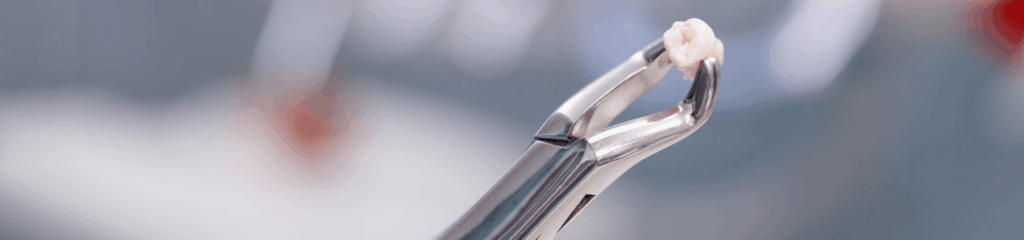 お口周りのトラブルを解決する、外科医療のプロフェッショナル｜宮本医院の歯科