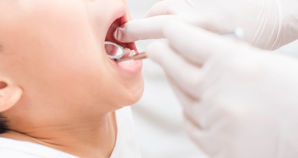 お口を開ける練習｜宮本医院の歯科