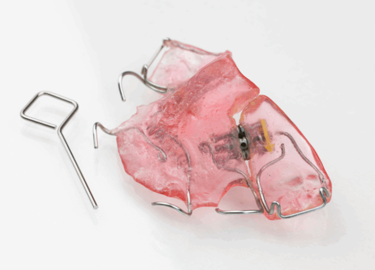 床矯正｜宮本医院の歯科