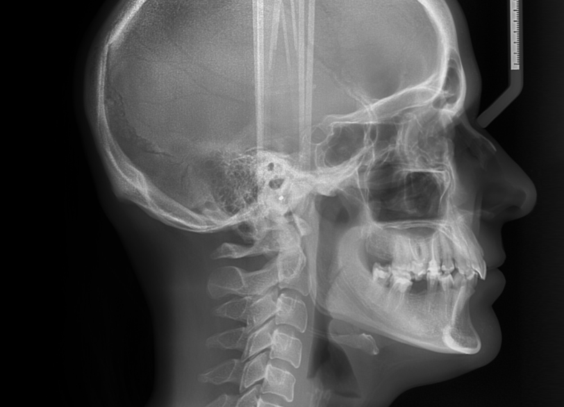 セファログラム｜宮本医院の歯科