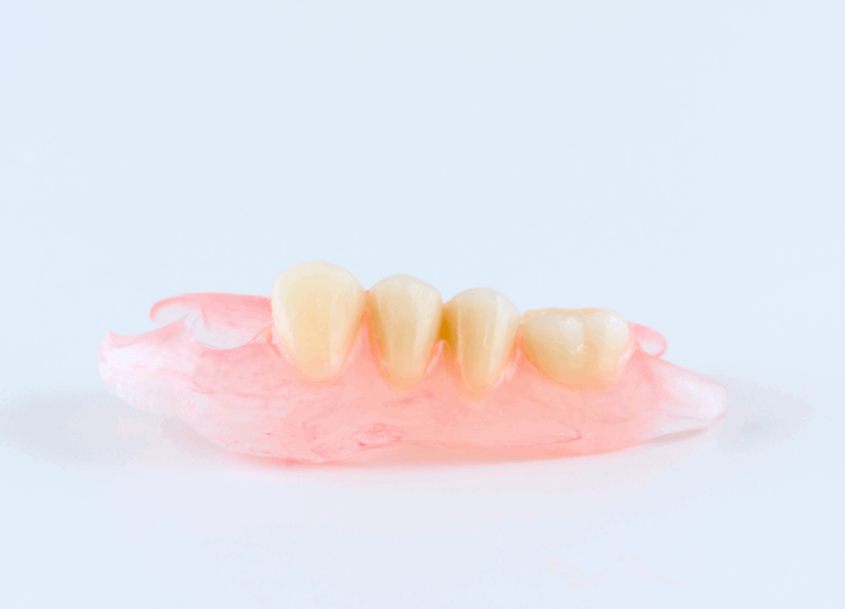 ノンクラスプデンチャー｜宮本医院の歯科