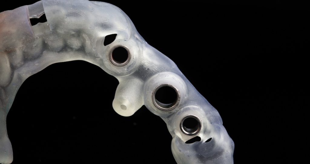 サージカルガイド｜宮本医院の歯科