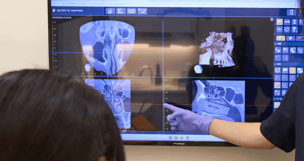 口腔外科認定医による専門的な顎関節症治療｜宮本医院の歯科