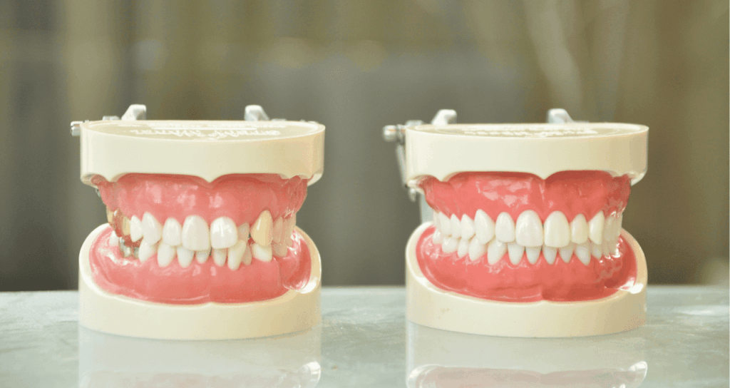 削って合わせるのではなく、位置を正す｜宮本医院の歯科