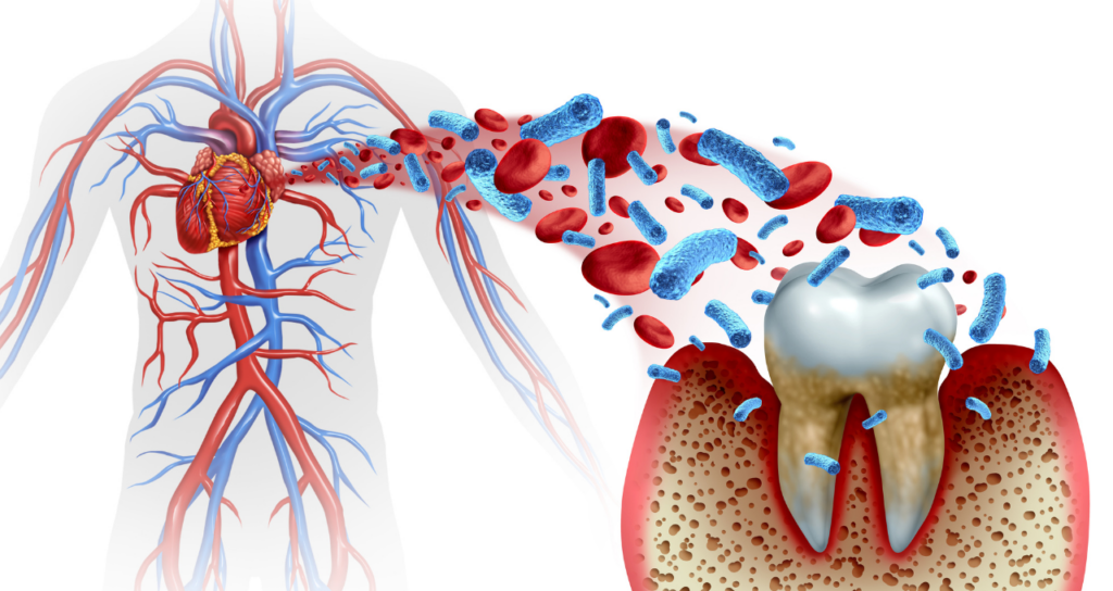 全身疾患のリスクを下げるために｜宮本医院の歯科