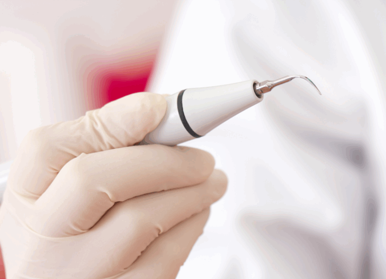 超音波スケーラー｜宮本医院の歯科