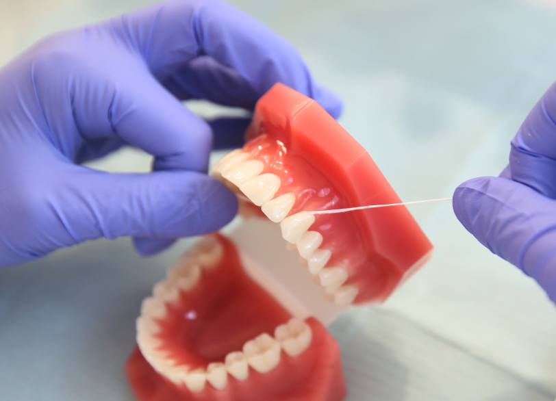 フロッシング（歯間清掃）｜宮本医院の歯科 