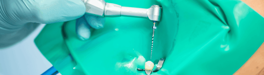 根管治療の流れ|宮本医院の歯科