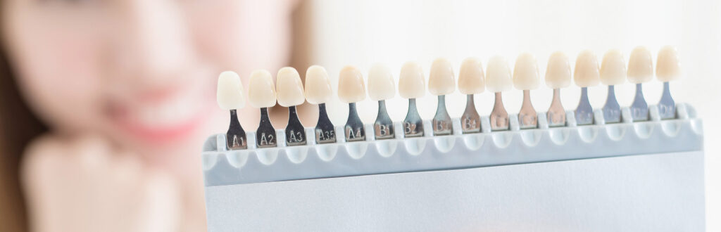 白い歯がもたらす笑顔への自信｜宮本医院の歯科