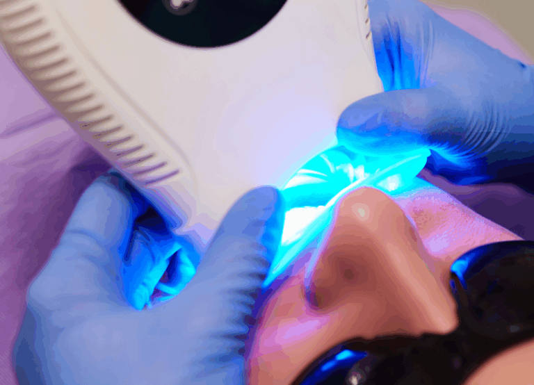 オフィスホワイトニング｜宮本医院の歯科